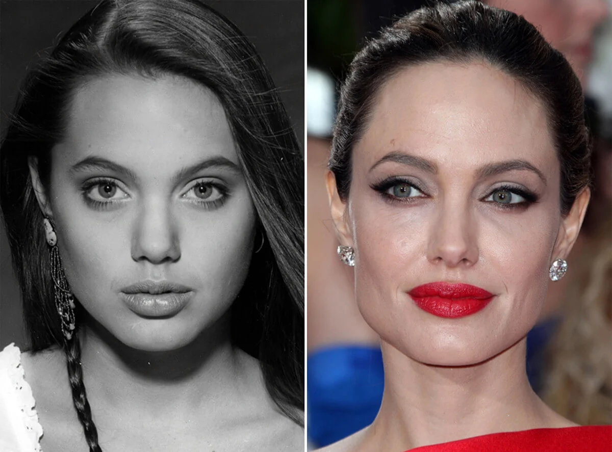 Анджелина Джоли до пластики