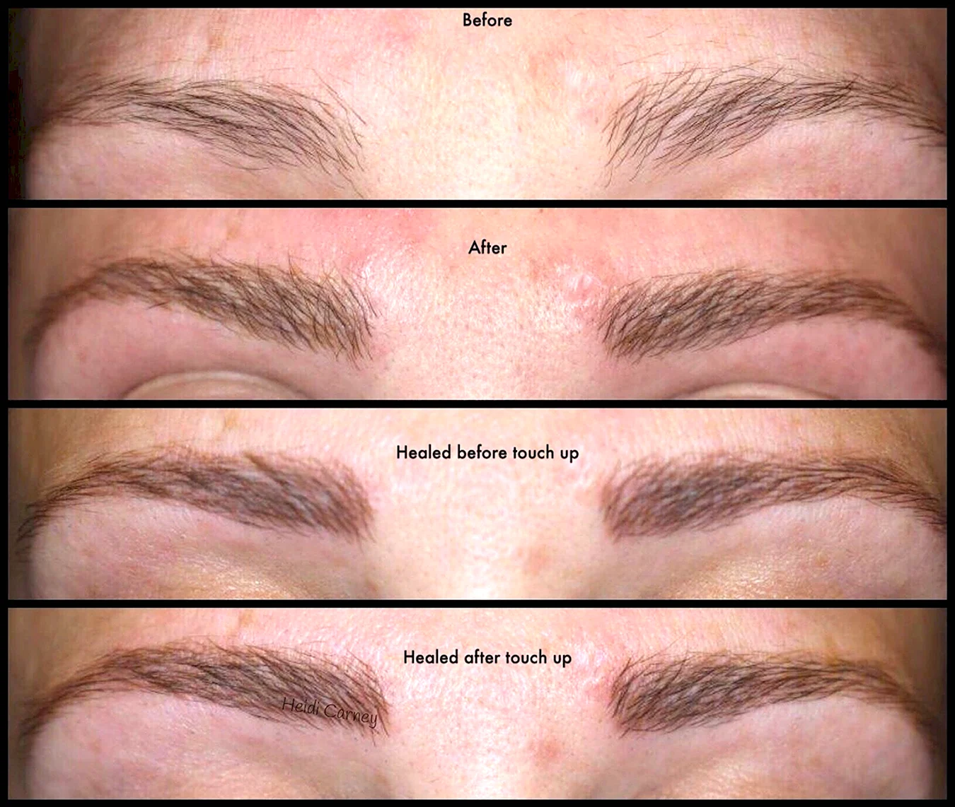 Этапы заживления перманентного макияжа бровей