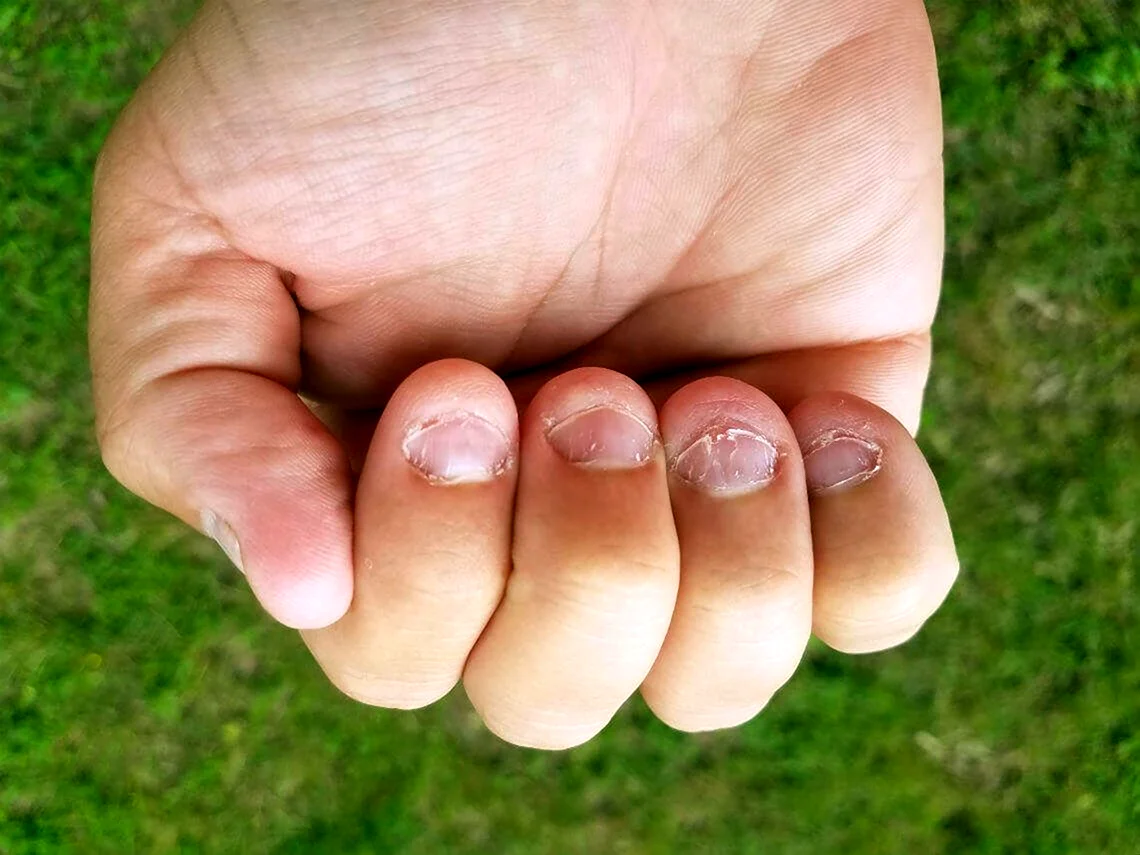 Короткие ногти на руках