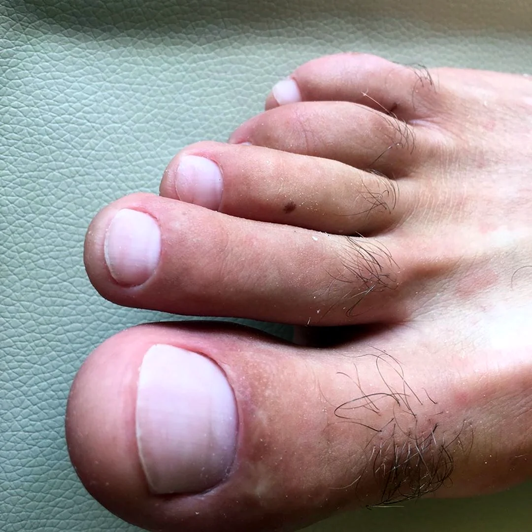 Красивые мужские ногти на ногах