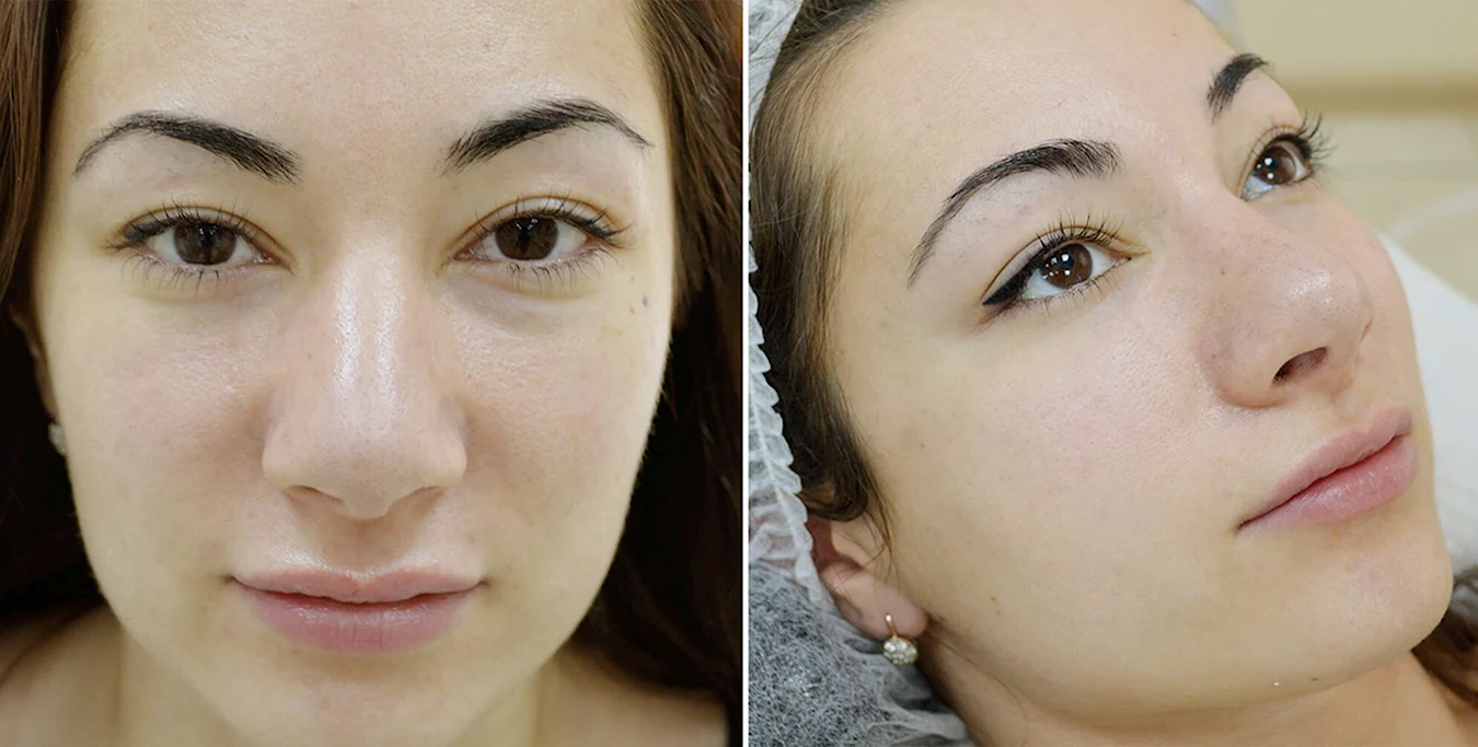Межресничка перманентный макияж до и после
