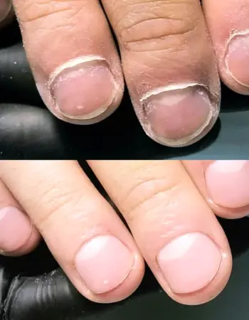 Мужские ногти