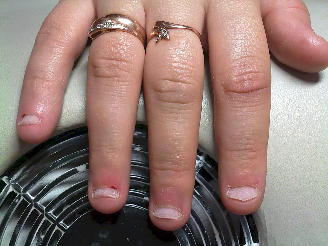 Некрасивые короткие ногти