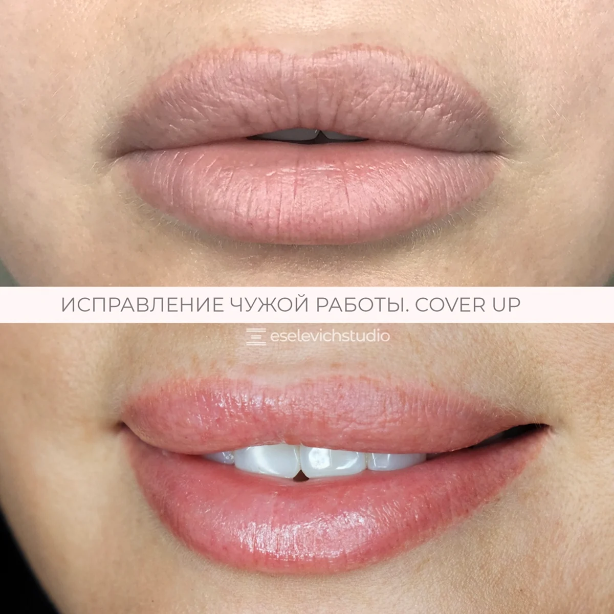 Неудачный перманентный макияж губ фото до и после