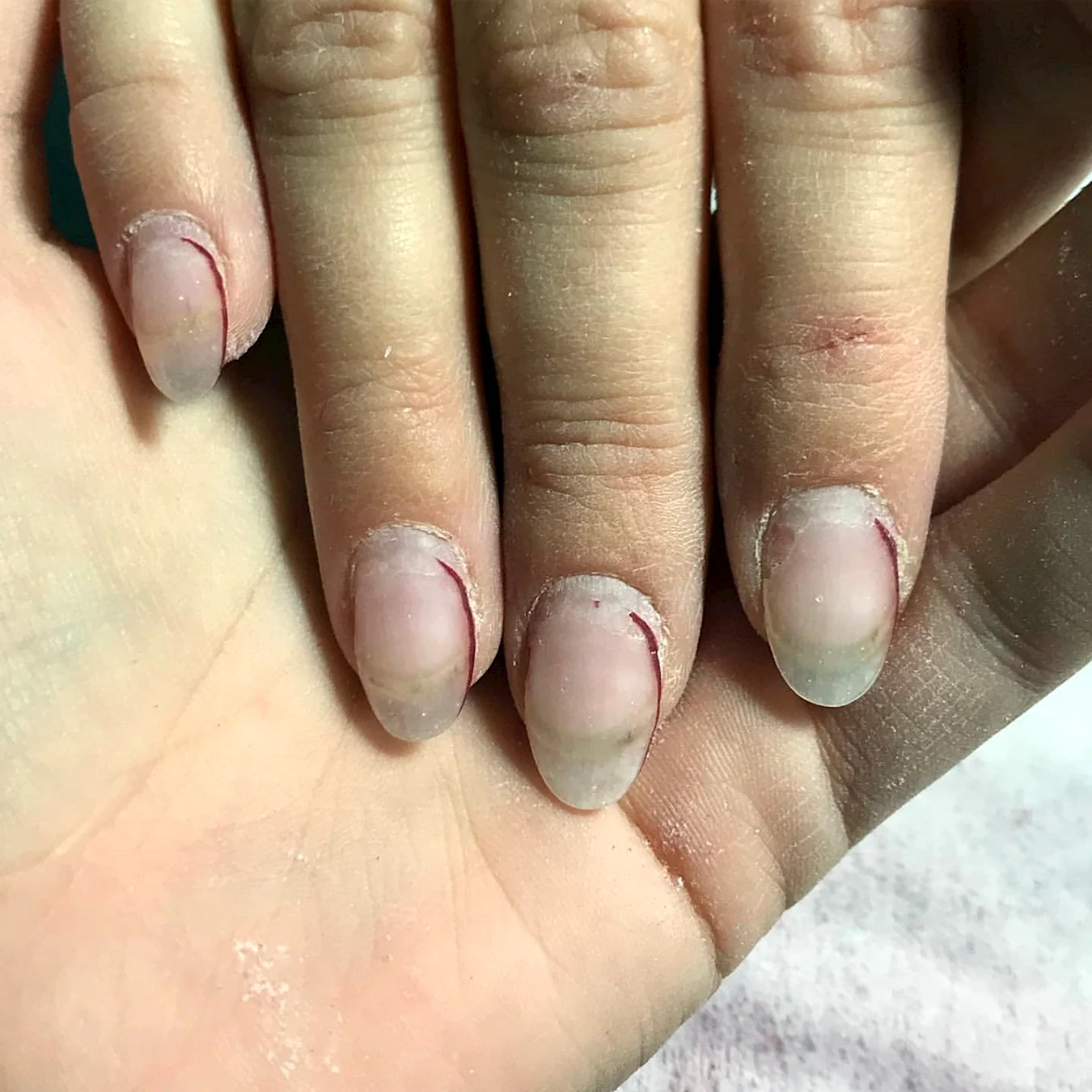 Отросшие нарощенные ногти