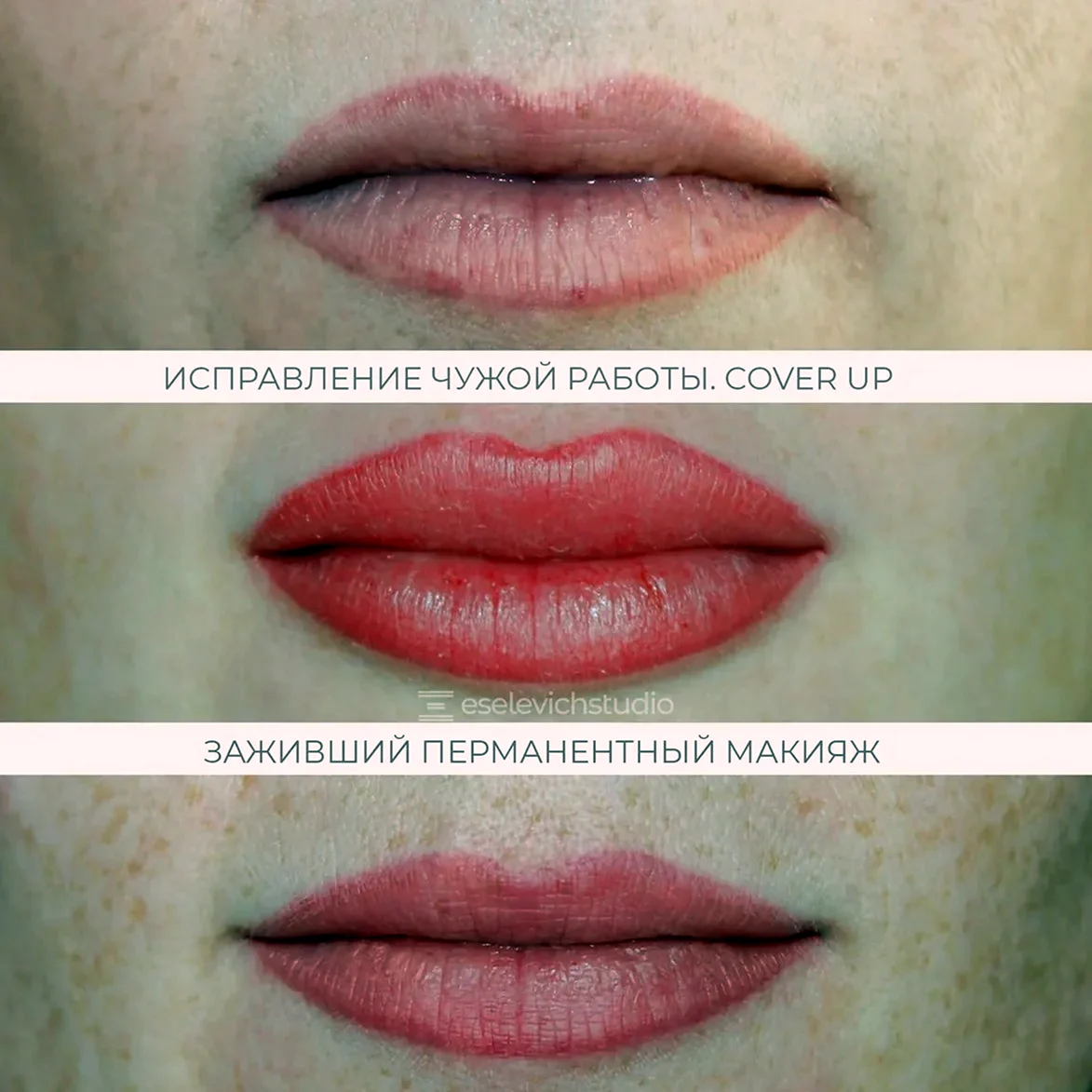 Перекрытие перманентного макияжа губ