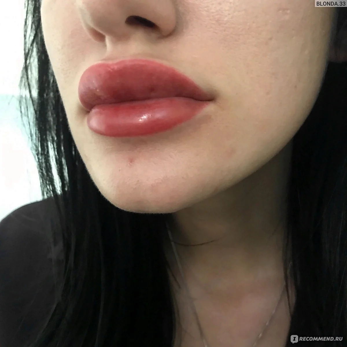 Перманентный макияж губ отек
