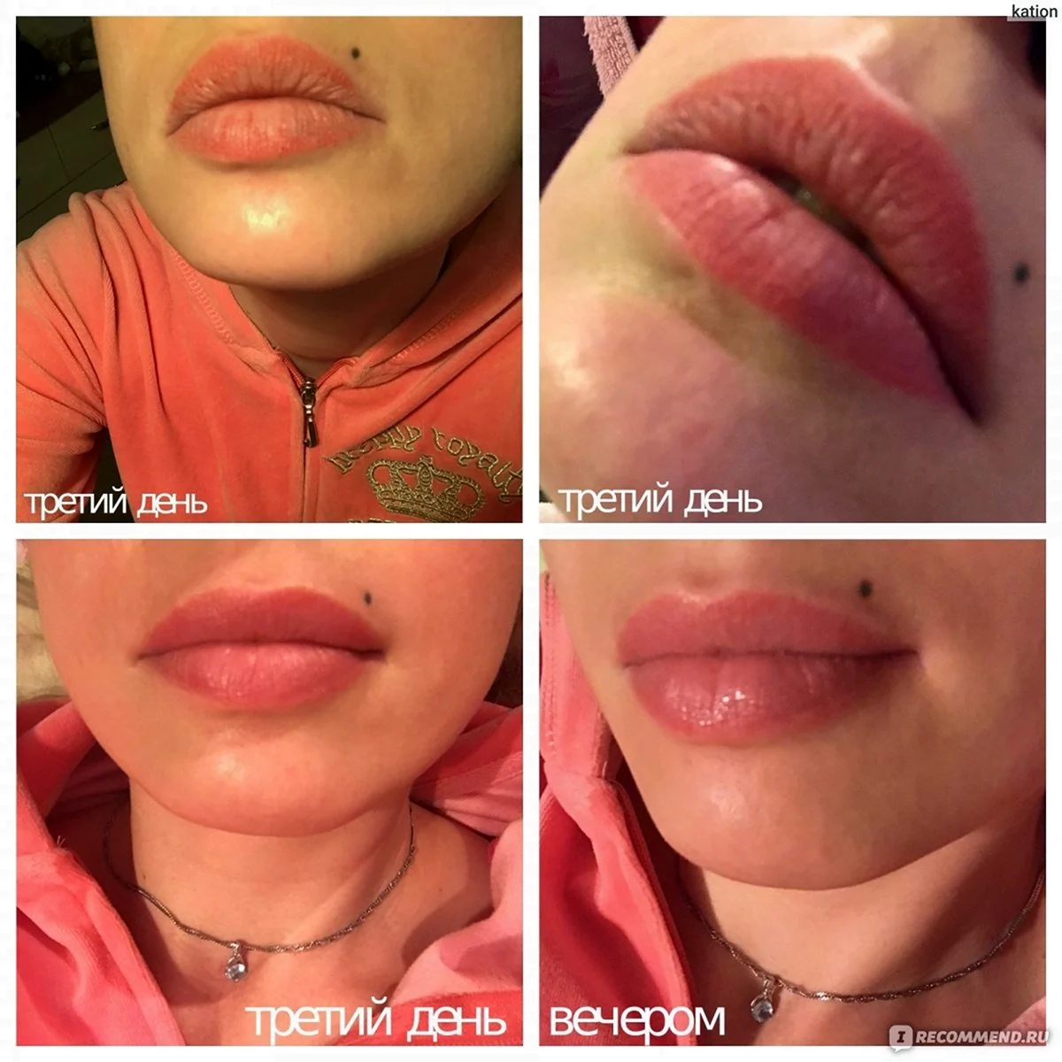 Перманентный макияж губ после заживления