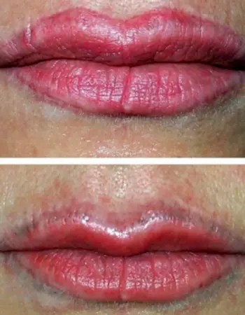 Перманентный макияж губ за контур