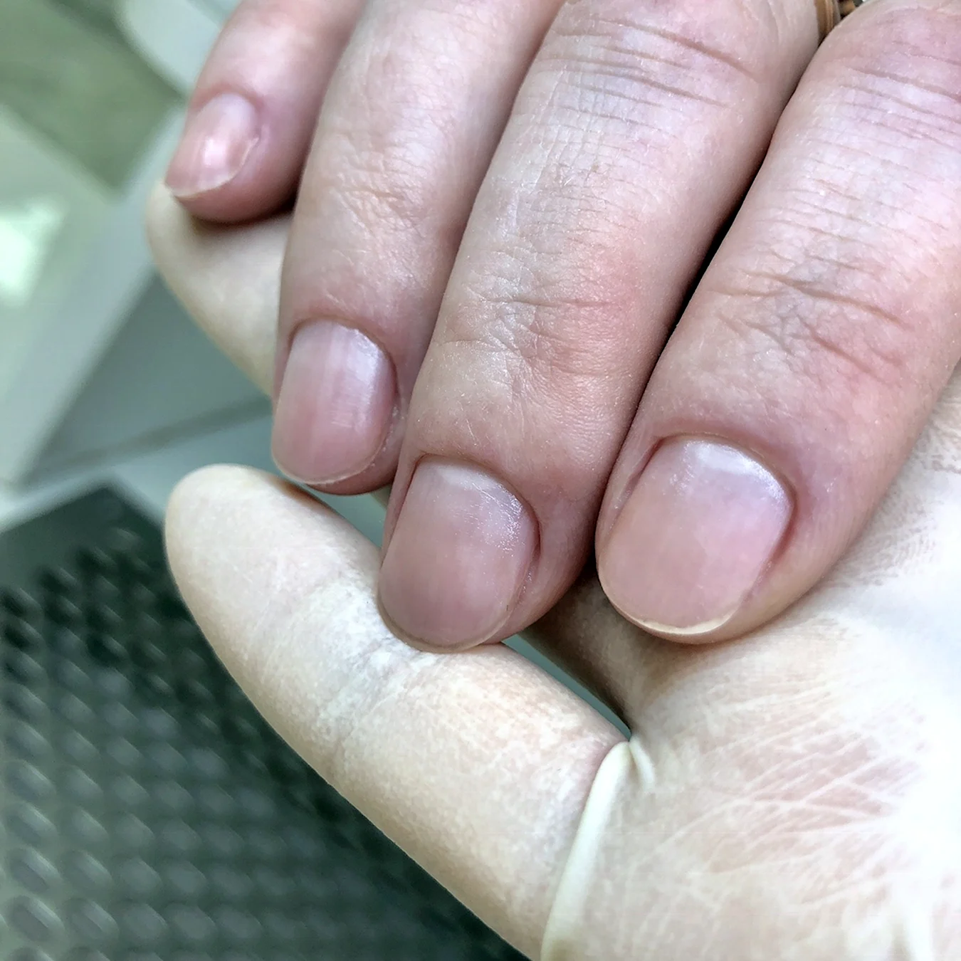 Пропилы на ногтях после аппаратного