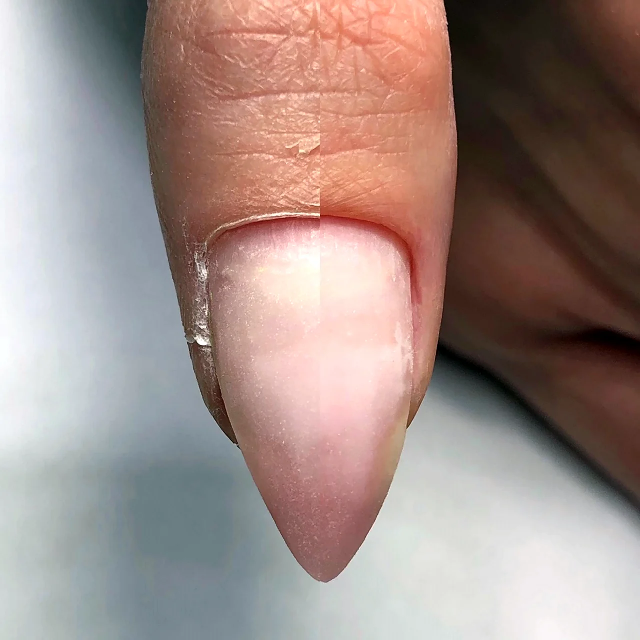 Пропилы на ногтях после аппаратного маникюра
