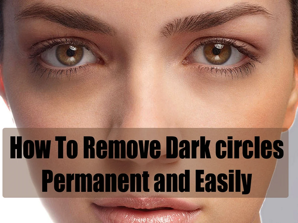 Remove Dark circles