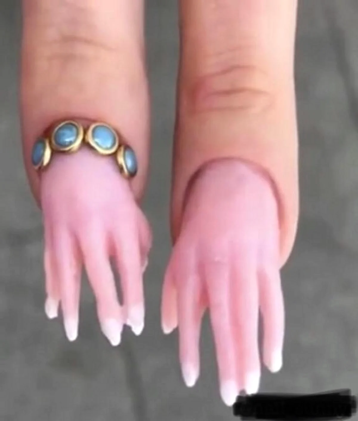 Самые некрасивые ногти в мире