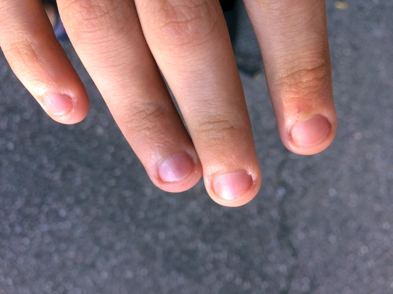 Широкие ногти на руках у мужчин