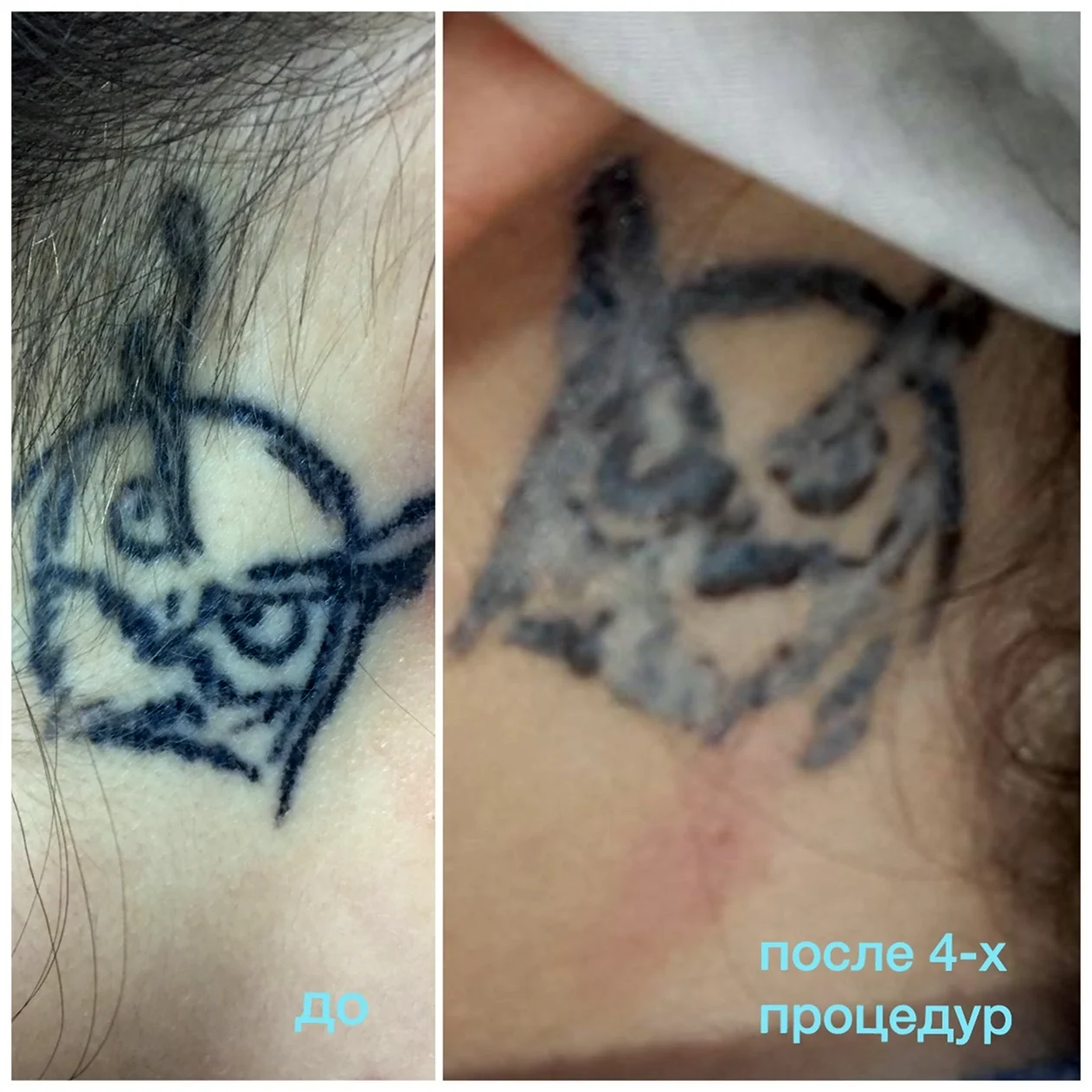 Татуировка до и после заживления