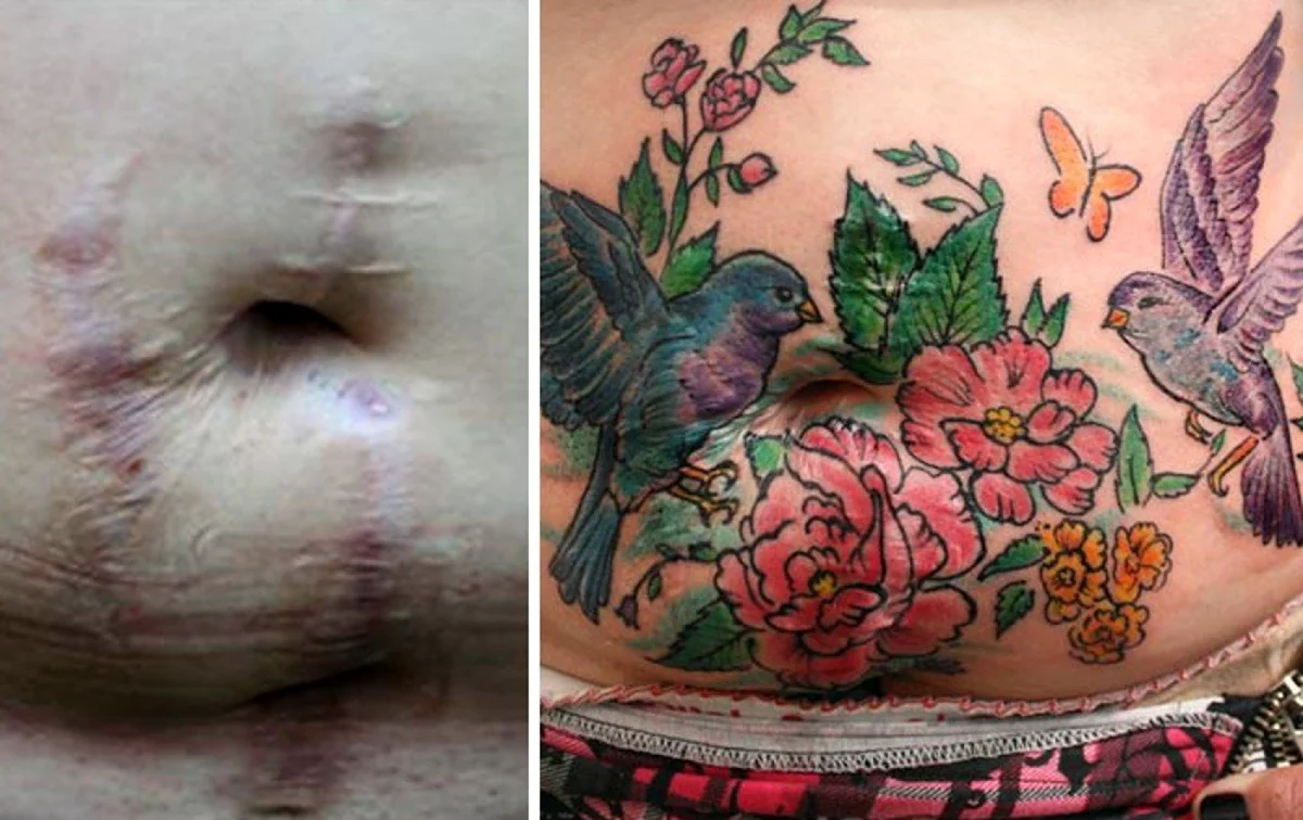 Татуировки на животе на шраме у женщин