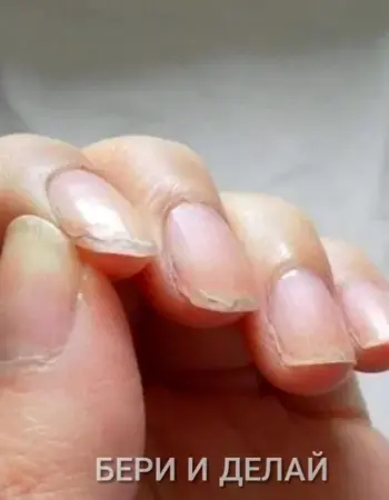 Тонкие ногти