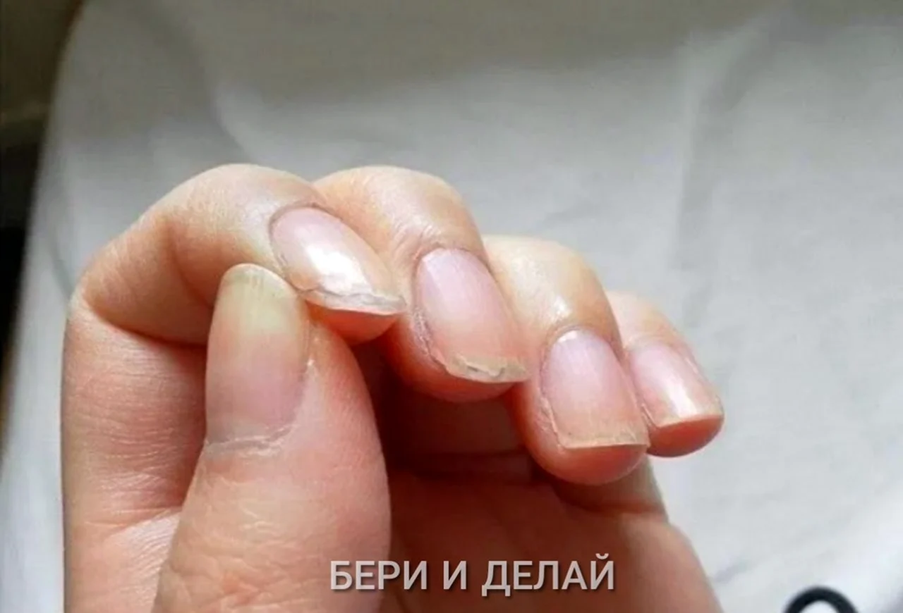 Тонкие ногти