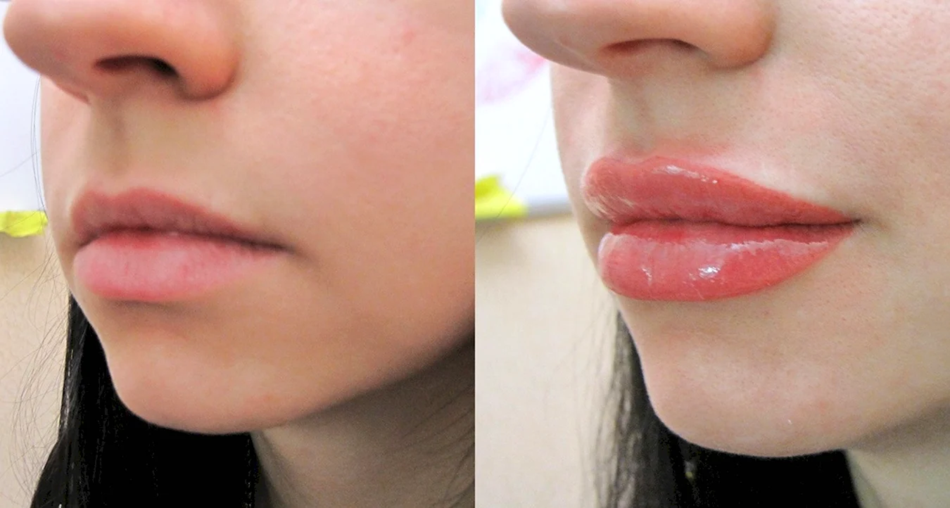 Зажившие губы после перманентного макияжа