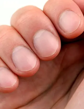 Здоровые ногти на руках