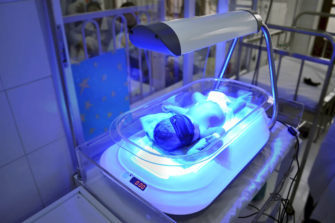 Желтушка у новорожденных фототерапия